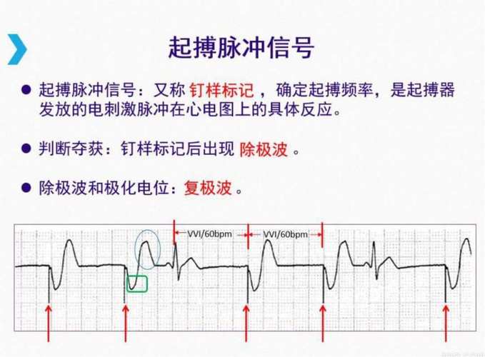 心臟起搏器電路
