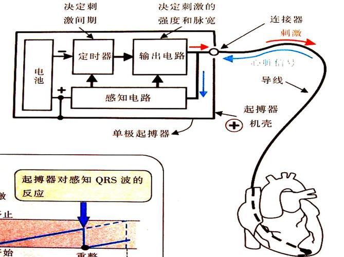 心臟起搏器電路原理圖